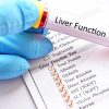 Liver Function Test